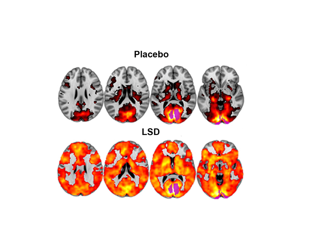 LSD DMN -Psychedelica en het Default Mode Network (DMN)